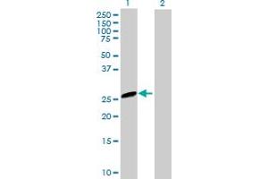 Western Blot analysis of EVI2A expression in transfected 293T cell line by EVI2A MaxPab polyclonal antibody. (EVI2A Antikörper  (AA 25-236))