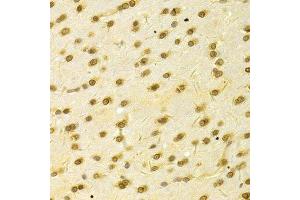 Immunohistochemistry (Paraffin-embedded Sections) (IHC (p)) image for anti-Hepatoma-Derived Growth Factor (HDGF) (AA 1-240) antibody (ABIN6141694)