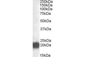 Western Blotting (WB) image for anti-Cysteine and Glycine-Rich Protein 3 (CSRP3) (Internal Region) antibody (ABIN2466624) (CSRP3 Antikörper  (Internal Region))