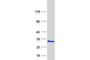 Validation with Western Blot (LRRC20 Protein (Transcript Variant 1) (Myc-DYKDDDDK Tag))