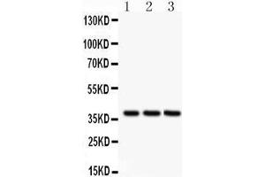 Anti-Bonzo antibody, Western blotting All lanes: Anti Bonzo  at 0. (CXCR6 Antikörper  (C-Term))