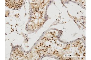 Immunoperoxidase of monoclonal antibody to ZAK on formalin-fixed paraffin-embedded human prostate. (ZAK Antikörper  (AA 1-120))