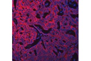 IF analysis of SWAP70 using anti-SWAP70 antibody (ABIN7600201). (SWAP70 Antikörper  (AA 161-292))