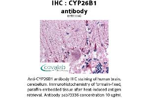 Image no. 2 for anti-Cytochrome P450, Family 26, Subfamily B, Polypeptide 1 (CYP26B1) (AA 160-396) antibody (ABIN1733454)