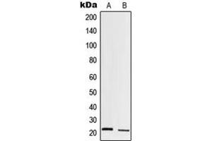 Western blot analysis of Trypsin 1 expression in HT1080 (A), human pancreas (B) whole cell lysates. (PRSS1 Antikörper  (Center))