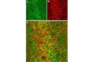 Expression of NMDA receptor 2B in rat hippocampus - Immunohistochemical staining of rat hippocampal CA1 frozen sections stained with Anti-NMDAR2B (GluN2B) (extracellular) Antibody (ABIN7043230, ABIN7044326 and ABIN7044327), (1:100). (GRIN2B Antikörper  (Extracellular))