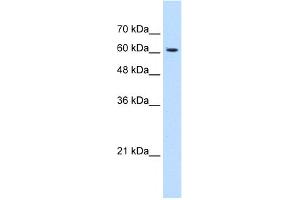 WB Suggested Anti-KIAA0319 Antibody Titration:  1. (KIAA0319 Antikörper  (N-Term))