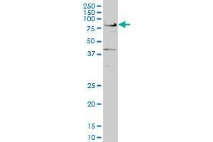 Western Blotting (WB) image for anti-Transcription Factor 7-Like 2 (T-Cell Specific, HMG-Box) (TCF7L2) (AA 1-455) antibody (ABIN520776)