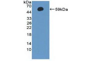 Detection of Recombinant CCNA1, Human using Polyclonal Antibody to Cyclin A1 (CCNA1) (Cyclin A1 Antikörper  (AA 183-430))