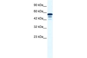 Western Blotting (WB) image for anti-Zinc Finger Protein 230 (ZNF230) antibody (ABIN2461216) (ZNF230 Antikörper)