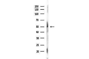 Western blot analysis of lysates from Hela cells(starvation,24h treatment), using Mnk1 Antibody at 1/1000 dilution.