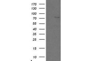 Image no. 1 for anti-SKI-Like Oncogene (SKIL) (AA 307-684) antibody (ABIN1491385) (SKIL Antikörper  (AA 307-684))