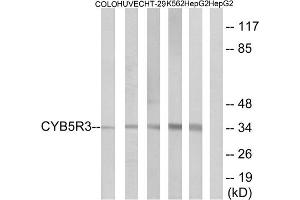 Western blot analysis of extracts from COLO cells, HUVEC cells, HT-29 cells, K562 cells and HepG2 cells, using CYB5R3 antibody. (CYB5R3 Antikörper  (Internal Region))