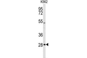 Western Blotting (WB) image for anti-Claudin 18 (CLDN18) (AA 231-259) antibody (ABIN3004093) (Claudin 18 Antikörper  (AA 231-259))