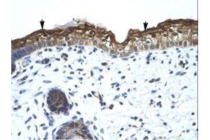 Image no. 1 for anti-SWI/SNF Related, Matrix Associated, Actin Dependent Regulator of Chromatin, Subfamily A, Member 2 (SMARCA2) (AA 58-107) antibody (ABIN6736031)