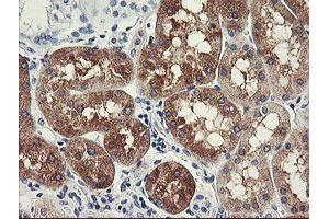 Immunohistochemical staining of paraffin-embedded Human Kidney tissue using anti-FTCD mouse monoclonal antibody.