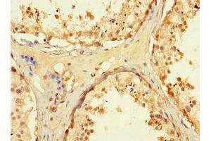 Immunohistochemistry of paraffin-embedded human testis tissue using ABIN7171480 at dilution of 1:100 (WRB Antikörper  (AA 38-99))