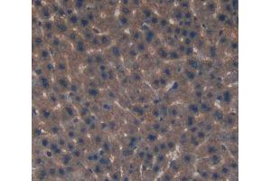 Used in DAB staining on fromalin fixed paraffin- embedded Kidney tissue (EIF2D Antikörper  (AA 360-570))