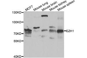Western blot analysis of extracts of various cell lines, using EZH1 antibody. (EZH1 Antikörper)