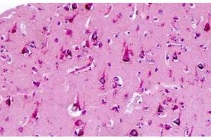 Human Brain: Formalin-Fixed, Paraffin-Embedded (FFPE) (CNR2 Antikörper  (AA 191-240))