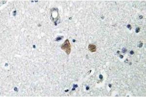 Immunohistochemistry (IHC) analyzes of mTOR antibody in paraffin-embedded human brain tissue. (MTOR Antikörper  (pSer2448))
