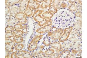 Formalin-fixed and paraffin embedded rat kidney labeled with Rabbit Anti-CD11b/c Polyclonal Antibody, Unconjugated  at 1:200 followed by conjugation to the secondary antibody and DAB staining (CD11b Antikörper  (AA 520-570))