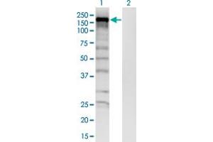 Western Blot analysis of SKIV2L expression in transfected 293T cell line by SKIV2L monoclonal antibody (M05), clone 1E5. (SKIV2L Antikörper  (AA 1125-1233))