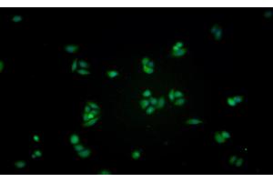 Detection of GLa in Human MCF7 cell using Monoclonal Antibody to Galactosidase Alpha (GLa) (GLA Antikörper  (AA 81-429))