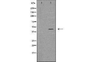 Western blot analysis of extracts of Y79, using ADIPOR1 antibody. (Adiponectin Receptor 1 Antikörper  (C-Term))