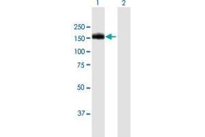 Western Blot analysis of BCR expression in transfected 293T cell line by BCR MaxPab polyclonal antibody. (BCR Antikörper  (AA 1-1076))