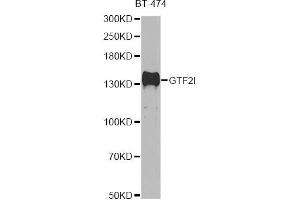 Western blot analysis of extracts of BT-474 cells, using GTF2I antibody (ABIN5995399) at 1/500 dilution. (GTF2I Antikörper)