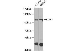 Western blot analysis of extracts of various cell lines, using LZTR1 antibody (ABIN6130529, ABIN6143415, ABIN6143416 and ABIN6223199) at 1:1000 dilution. (LZTR1 Antikörper  (AA 300-545))