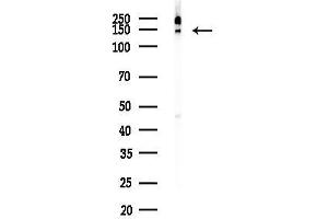 anti-BCL2-Associated Transcription Factor 1 (BCLAF1) (Internal Region) antibody