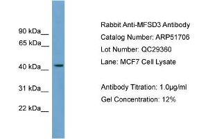 WB Suggested Anti-MFSD3  Antibody Titration: 0.