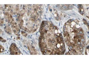 ABIN6276838 at 1/100 staining Human prostate tissue by IHC-P. (TLR5 Antikörper  (C-Term))