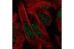 Immunofluorescent staining of RH30 cells with SIX1 monoclonal antibody, clone CL0185  (Green) shows spotty nuclear.