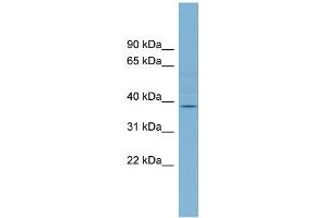 WB Suggested Anti-B3GALNT1 Antibody Titration:  0. (B3GALNT1 Antikörper  (Middle Region))