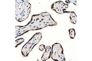IHC analysis of SNRNP200 using anti-SNRNP200 antibody (ABIN7602032). (SNRNP200 Antikörper  (AA 557-2129))