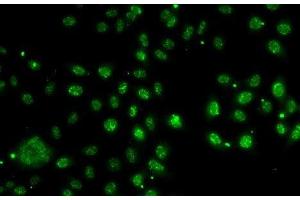 Immunofluorescence analysis of A-549 cells using LDLRAP1 Polyclonal Antibody (LDLRAP1 Antikörper)