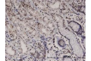 Immunoperoxidase of monoclonal antibody to PTK6 on formalin-fixed paraffin-embedded human stomach. (PTK6 Antikörper  (AA 342-451))