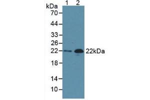 Western Blot; Sample: Lane1: Human Serum; Lane2: Rat Heart Tissue. (NT-ProBNP Antikörper)