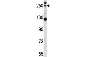 C4B antibody western blot analysis in mouse lung tissue lysate (C4B Antikörper  (AA 655-684))