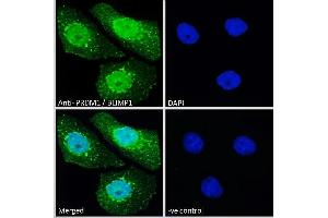 ABIN570911 Immunofluorescence analysis of paraformaldehyde fixed A431 cells, permeabilized with 0. (PRDM1 Antikörper  (C-Term))