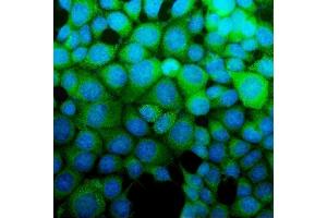 IF analysis of ASS1 using anti-ASS1 antibody (ABIN7601191). (ASS1 Antikörper  (AA 3-365))