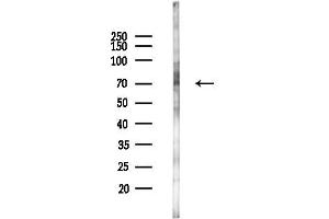 Western blot analysis of lysates from LoVo cells(heat-shock,45 min treatment), using CYP26 Antibody at 1/1000 dilution.