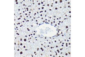 Immunohistochemistry of paraffin-embedded mouse liver using Phospho-Rb-S780 antibody (ABIN7269936) at dilution of 1:100 (40x lens). (Retinoblastoma 1 Antikörper  (pSer780))