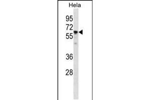 Western blot analysis in Hela cell line lysates (35ug/lane). (CCT7 Antikörper  (N-Term))