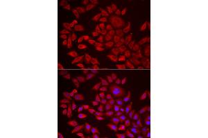 Immunofluorescence analysis of HeLa cells using AGPAT2 antibody (ABIN5973903). (AGPAT2 Antikörper)