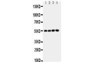 Anti-NRF1 antibody, Western blotting Lane 1: Rat Brain Tissue Lysate Lane 2: Rat Kidney Tissue Lysate Lane 3: MCF-7 Cell Lysate Lane 4: A549 Cell Lysate (NRF1 Antikörper  (Middle Region))