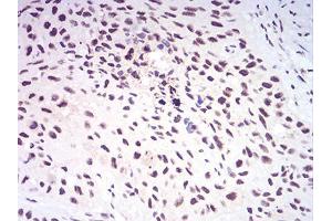 Immunohistochemistry (IHC) image for anti-Lysine (K)-Specific Demethylase 1A (KDM1A) (AA 55-263) antibody (ABIN5542574)